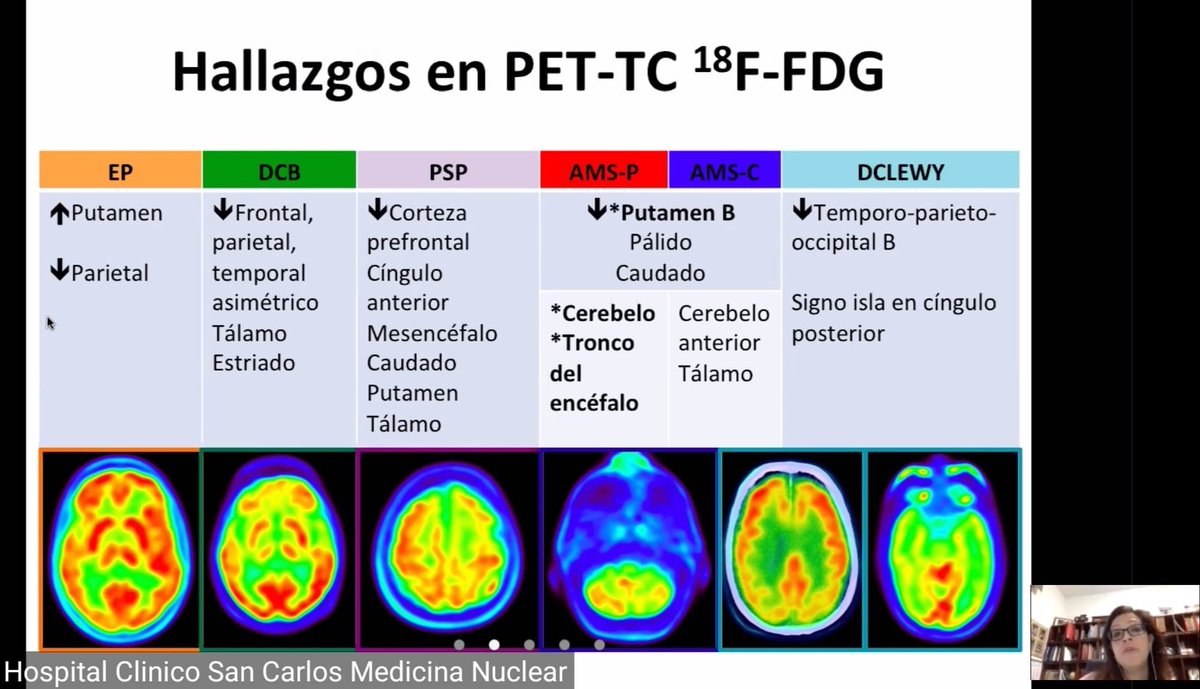 MaraNievesCabr1's tweet photo. Hoy en nuestra sesión virtual de #MedicinaNuclear del HCSC hemos hablado de la aportación de #DaTSCAN, #PET-FDG y #PET con trazadores Tau al diagnóstico de los trastornos del movimiento. #PET-FDG sin duda muy útil en la diferenciación de parkinsonismos atípicos #somosclinico https://t.co/eieMz4pgCs