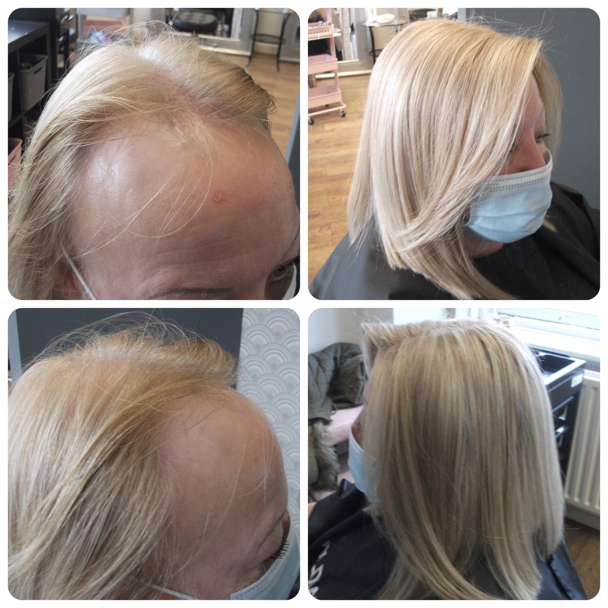 HairSolved's tweet photo. Each system is tailored to your exact requirements, adding volume to thinning hair or providing the perfect solution to total hair loss.
To find our more about our #meshintegrationsystem visit https://t.co/KZ0RRB0Z8J
#femalehairloss #hairlossexperts #hairlosssalons https://t.co/hM1tkOuz6i