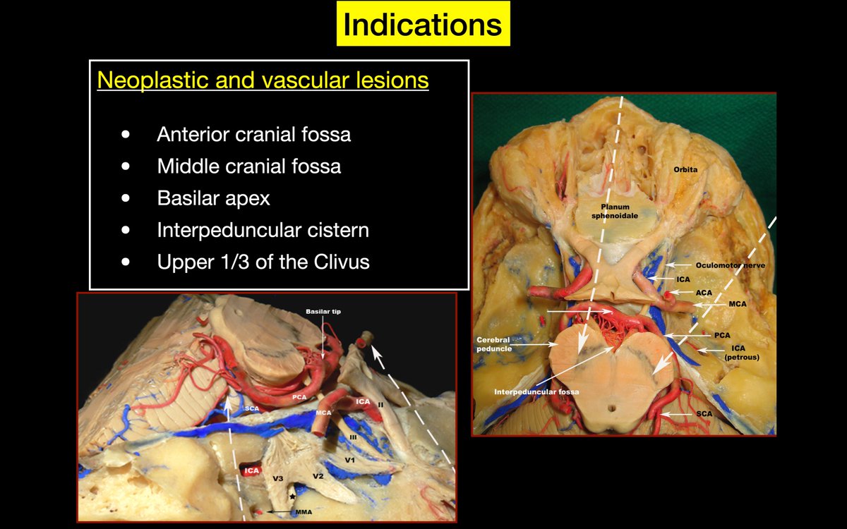 Dr. Mustafa K. Baskaya, MD tweet media