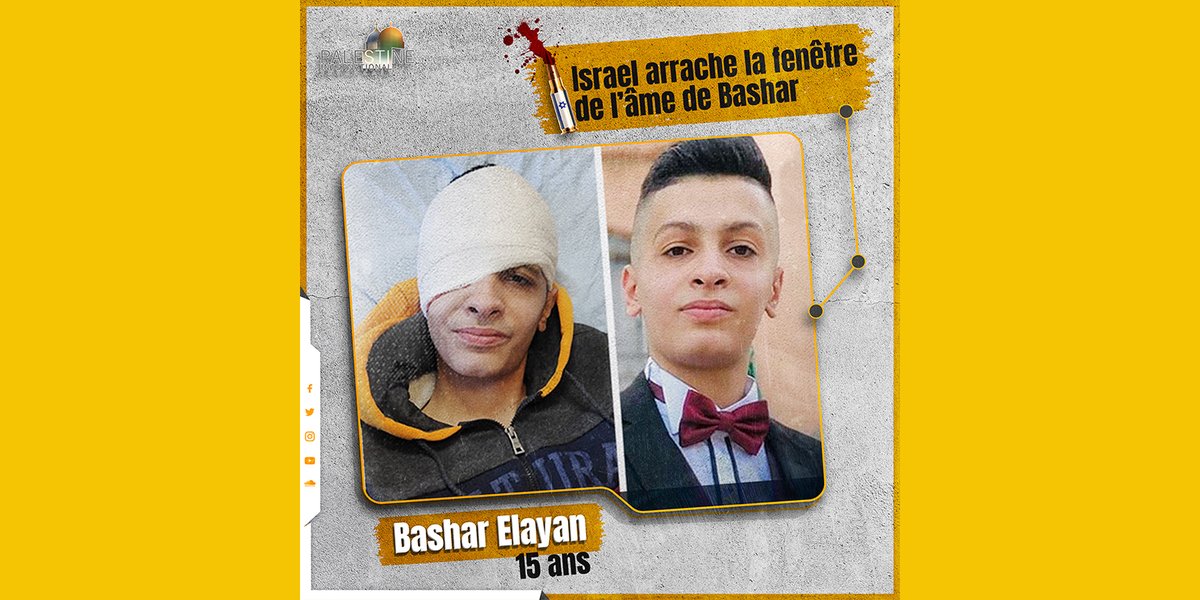 Pbi_Fr's tweet photo. Les forces israeliennes ont #abbatu l'#enfant palestinien,Bashar Elayan,15 ans,dans l'oeil droit en le lui #arrachant.Bashar était à son école au camp de #réfugiés de Qalandia lorsque les forces d’occupation israéliennes ont commencé le tir en direction des #élèves.  

#Martyre https://t.co/3ksXPfiTbK
