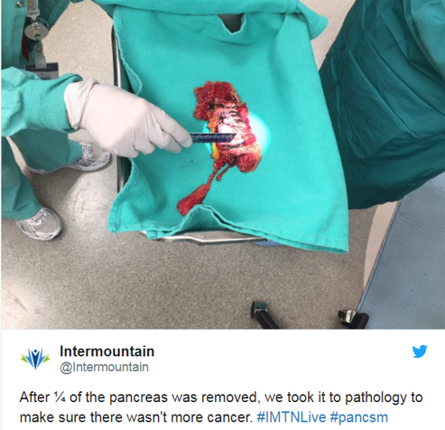 That's why I knew I was lucky, relatively speaking, to be diagnosed with a less aggressive neuroendocrine tumor that could be cured with surgeryIn 2017, I underwent the Whipple operation to remove my dominant cancer from the head of my pancreas4/