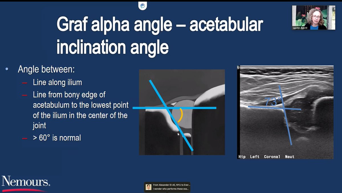 NemoursRads's tweet photo. Thanks to the Chair of #pedsrad @AIDHC @LaurenAverillMD for her brilliant talk on sonography of the hip. #hipdysplasia #MSK #radiologist #sonologist #ultrasound #RadRes #MedEd @CHOPRadiology @JeffersonRads @AmiGokli #NemoursRad https://t.co/EZD48GK2gN