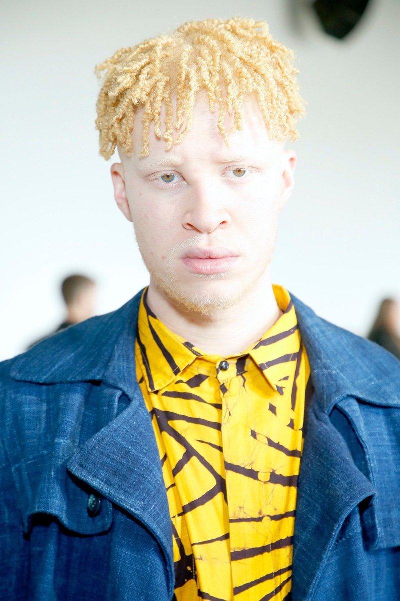 VogueChange's tweet photo. ショーン・ロスはソーシャルメディアで「 #InMySkinIWin (自身の中にこそ魅力がある)」と名付けた運動を開始。偏見や困難を何度も乗り越えてきた自らの経験から、苦しみの中にいる人々を救いたいという切実な願いが込めれていた。🤍
#アルビニズム
https://t.co/OeWf9QhdG9 https://t.co/FPlqm6r1Lq