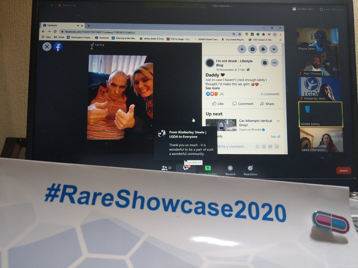 Ataxia_aware's tweet photo. Ashley @HDAssocNI speaks at the lightening talks  @findacure_fdn #RareShowcase2020  🛎 https://t.co/iAN2h0xPo2