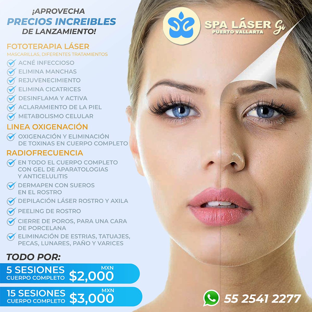 PDIclub's tweet photo. Aprovecha esta gran promoción de Spa Laser Gi puerto vallarta un precio de lanzamiento🤩 Todos sus servicios por: $2,000 5 sesiones o $3,000 15 sesiones 😱
🌐 https://t.co/tLwIkdizgh
📲 55 2541 2277

#pdiclub #spalaserpuertovallarta #beauty #relax #salon #facial https://t.co/EUhwwwbtef