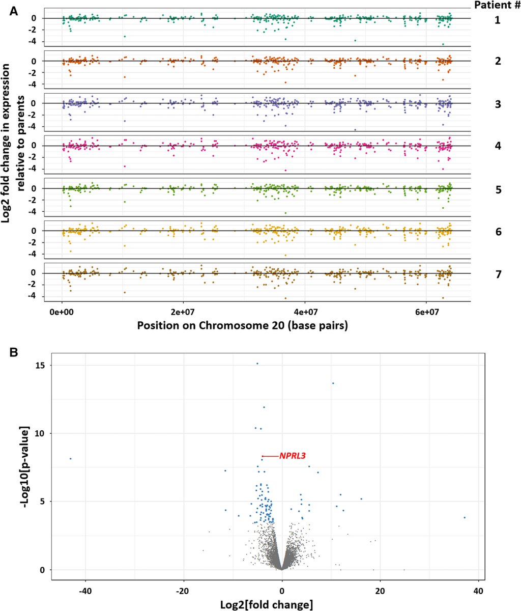 EpilepsiaJourn's tweet photo. Transcriptome analysis of a ring chromosome 20 patient cohort https://t.co/jBhA43o30C
BRIEF COMMUNICATION #epilepsy #ring20 #NPRL3 @IlaeWeb @wileyneurosci https://t.co/B9yeXAfY2X