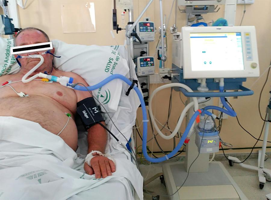 Across Arizona, the virus is overwhelming hospitals and several have run out of hi-flow nasal cannula machines, so now our only options are bipap or intubation for severe hypoxia. 5/9