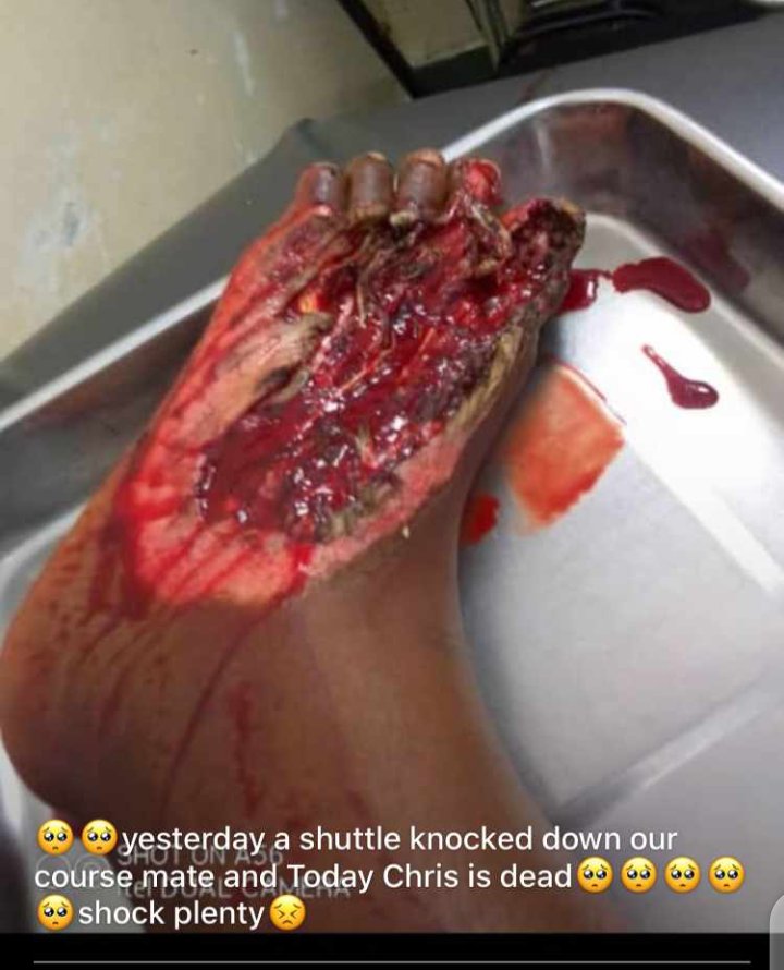 MaxAnkia's tweet photo. #sadnote
On a sad note, Multiple reports point to the fact that a certain student of the accounting department, University of Buea, has died. Reports from various status's on WhatsApp blame "her" untimely death to the recklessness of the campus shuttle that has been the sole https://t.co/TsyZ9nG4hw