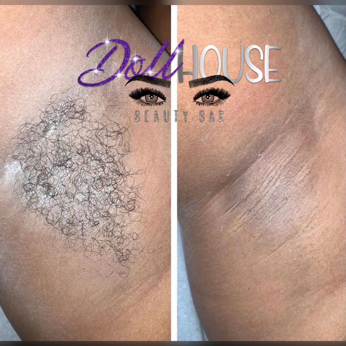 TheeBlackDOLL's tweet photo. Brazilian wax $30 and underarm $10 book it 💜 https://t.co/T2mkkuflIm https://t.co/uMxNg53Y4Q