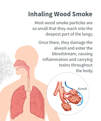 Diana51835949's tweet photo. Getting a persistent cough every morning now from breathing in localised #woodsmoke in #smokecontrolarea London.
#stopburningstuff https://t.co/tuJ4QyM6f6
