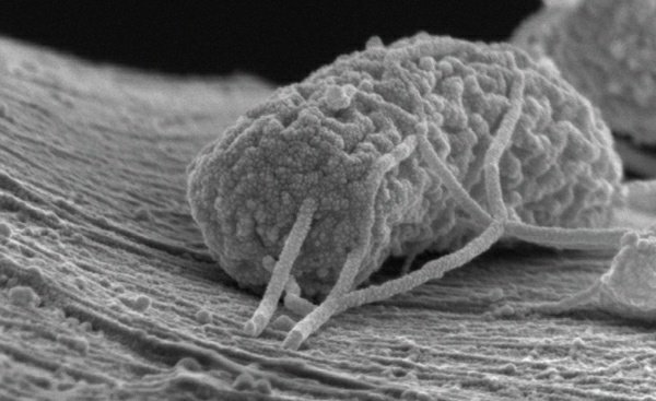 Every stray itch, or prickly feeling on the back of your neck is a gentle tickle from these Colossals, a trace sensation from a millisecond of them piercing through your skin and seeping in microscopic Cold Plasma. They are the Architects of every chill down your spine you've had