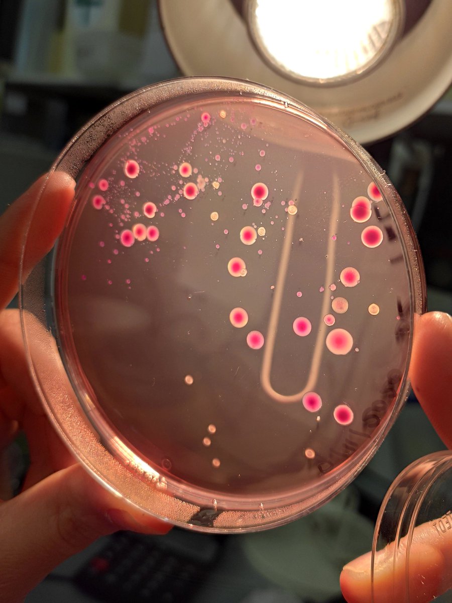 Cathy_94_'s tweet photo. E.coli colonies on Petri dish at @unitusviterbo 

#Biotechnology #University #italianuniversity #nature #microbialbiotechnology #agricultureresearch #bacteria #Microscopy #biosafety https://t.co/auEVU89tEF