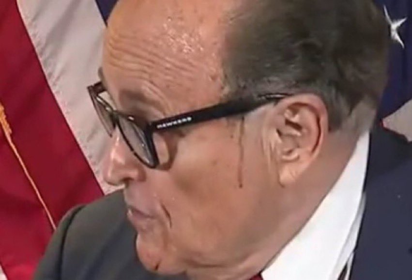 Earl No Shirt tweet media