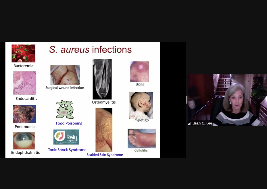 KennethWWitwer's tweet photo. Jean C. Lee presenting at #LEXS on prokaryotic #ExtracellularVesicles...starts with reminding us of the various problems associated with #SAureus infections. #LongwoodExtracellularVesicleSymposium https://t.co/3HdIoNaQyy