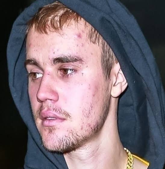 sonlythetruth's tweet photo. @PopCrave Well he doesn’t deserve respect so... https://t.co/kaaBRUtyFc