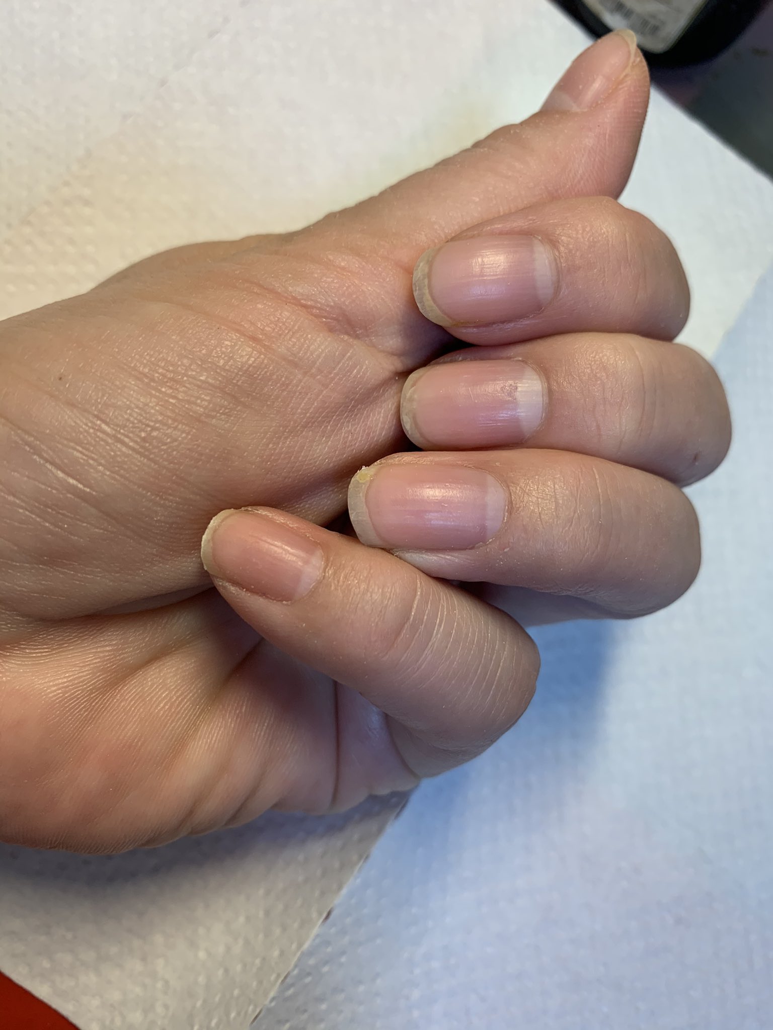 バイオジェル Twitter Search Twitter