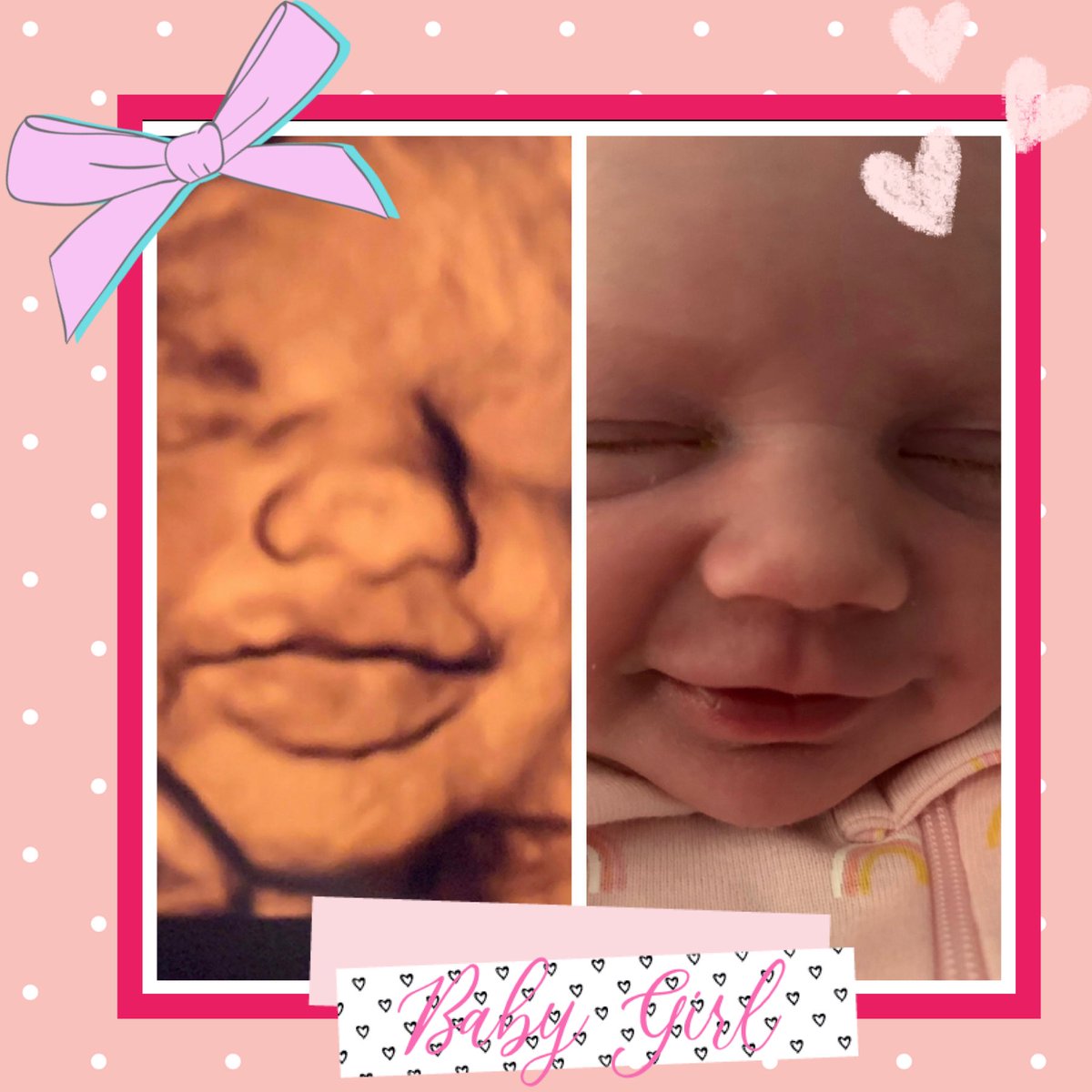 babyultrasound's tweet photo. Two of our clients sent in side by sides of their daughters today! 🙌🏼 Look how adorable both these baby girls are! 😍🥰 Send is yours! #ourclientsarethebestclients #adorablebaby3d #sidebyside #ultrasound #newborn #itsagirl #babygirl #socute #pretty #babypics #3d4d #danvilleca https://t.co/HnHZX6Wnp4
