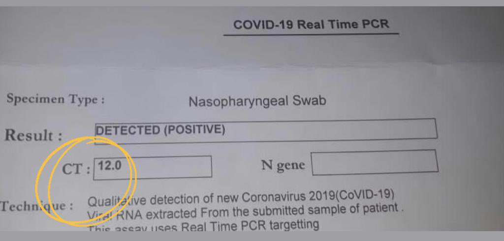 mjsayed's tweet photo. ماذا يعني الرقم CT على فحص PCR لل #COVID19 ؟
CT= Cycle Threshold
هو ليس نسبة مئوية و لكنه يعبّر بطريقة غير مباشرة عن العبئ الفيروسي
رقم CT > ٣٤ يعني عادة اصابة خفيفة ويتم تفسير هذا الرقم حسب حالة المريض وفترة العوارض،
كلما انخفض الCT كلما كان عبئ الفيروس أعلى يعني الاصابة أقوى! https://t.co/SAGbqTQ0g1