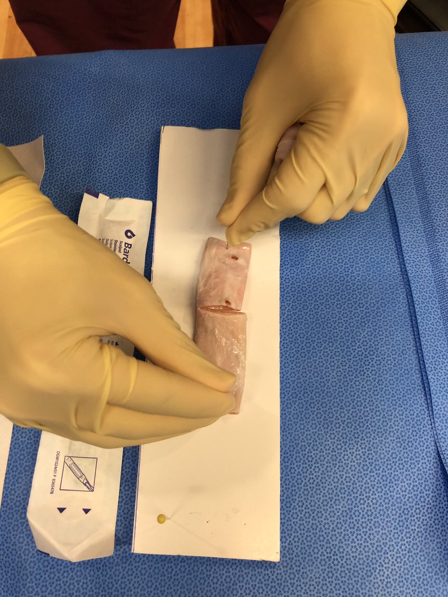 Last week we had a vascular anastomosis workshop! Dr Roman Nowygrod and senior residents took our junior residents through their first anastomoses. That 6-0 sure is tricky! But our seniors helped give tips to make it look smooth as butter.