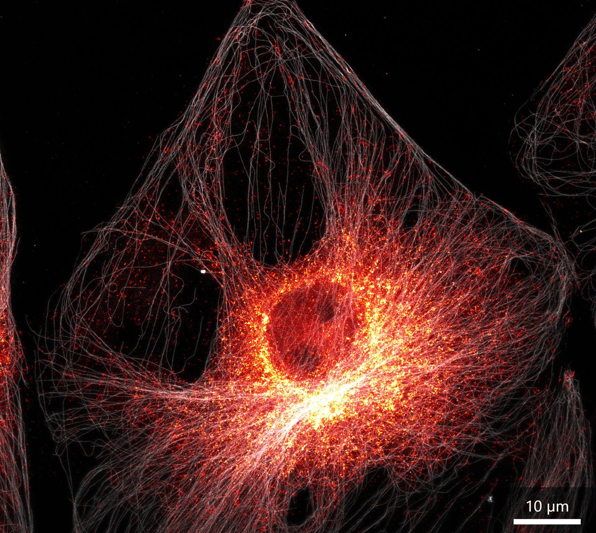 Abberior Beautiful Sted Image From The Newly Installed Infinityline At Usst Shanghai Dr Wang Yangyundou Prof Gu Min Group Usst Clathrin And Microtubule Sample Courtesy Dr Hao Huiwen Prof Sun Abberior Beautiful Sted Image From The Newly Installed Infinityline At Usst Shanghai Dr Wang Yangyundou Prof Gu Min Group Usst Clathrin And Microtubule Sample Courtesy Dr Hao Huiwen Prof Sun