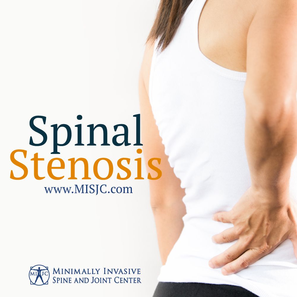 misjc's tweet image. Spinal stenosis is when the spinal column narrows, putting pressure on the spinal cord and spinal nerves.
Pressure on the spinal nerves causes symptoms such as: numbness, cramping, weakness.