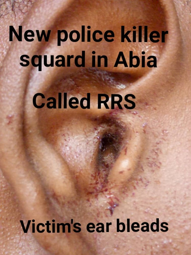 IpobosisiomaLga's tweet photo. Breaking!,
Abia state @PoliceNG commissioner Mrs #JanetAgbede 
Secretely Launched Police Unit  #RRS In Abia, they are secretely killing youths tagged them #Ipob/ #EndSarsprotester, they will Access your phone looking for #Biafra or #EndSars picture, SEE ear/body victim @StateDept https://t.co/Ojg5ud9Grd