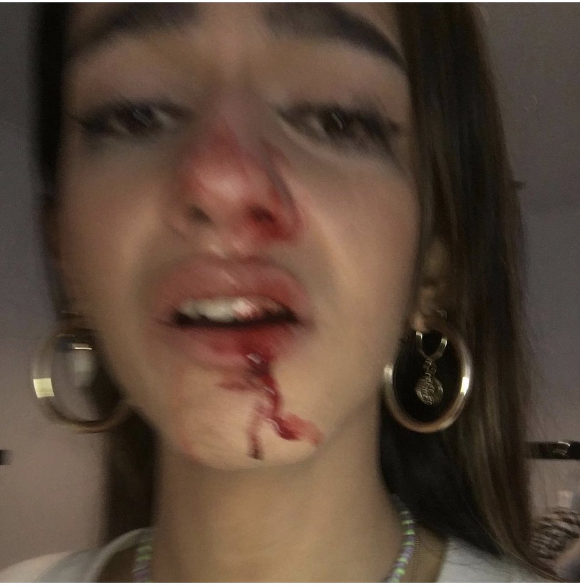 kikealvrez's tweet photo. Vergüenza me da que todavía haya estos comportamientos hacia personas que simplemente quieren vivir, sin hacer daño a nadie 💔 mucha fuerza @evacastt1 https://t.co/H9ecXR5Ur6
