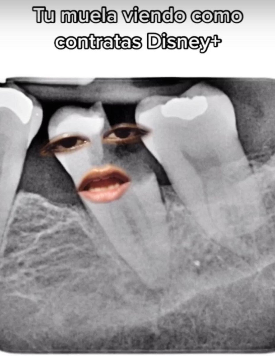 🦷🙃¿Que?