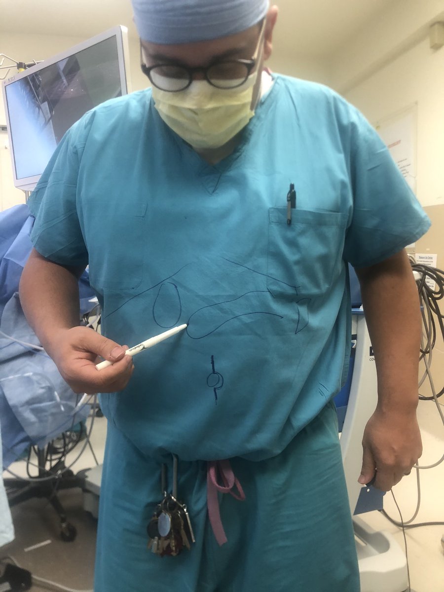FlavioRochaMD's tweet photo. Preoperative review of trocar placement and anatomical relationships for laparoscopic surgery with the residents. @HPBSurgeryatVM @VMsurgery https://t.co/0ngfVwGPXd