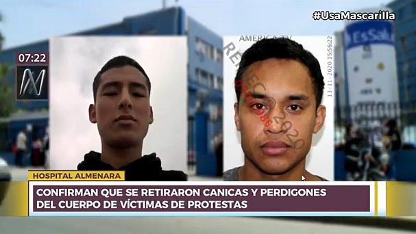 canalN_'s tweet photo. El Hospital Almenara confirmó que retiraron canicas de vidrio y perdigones de plomo de los cuerpos de las víctimas, tras las protestas en el Centro de Lima ► https://t.co/GmKqJ1UZg6 https://t.co/2nkEKbOzZq