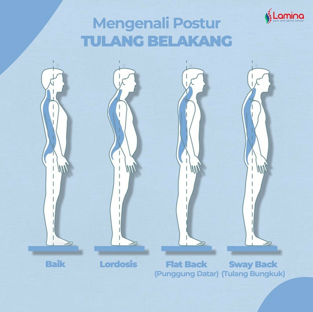 KlinikLamina's tweet photo. Tulang belakang berperan untuk menopang tubuh saat beraktivitas. Usahakan duduk tetap tegak agar tulang belakang Anda terjaga dengan baik. Begitu pula saat berdiri. 
Postur tubuh yang tidak terjaga dengan baik, bisa menyebabkan nyeri. Itu sebabnya kenali postur tubuh Anda da… https://t.co/0XgN5XNxT2