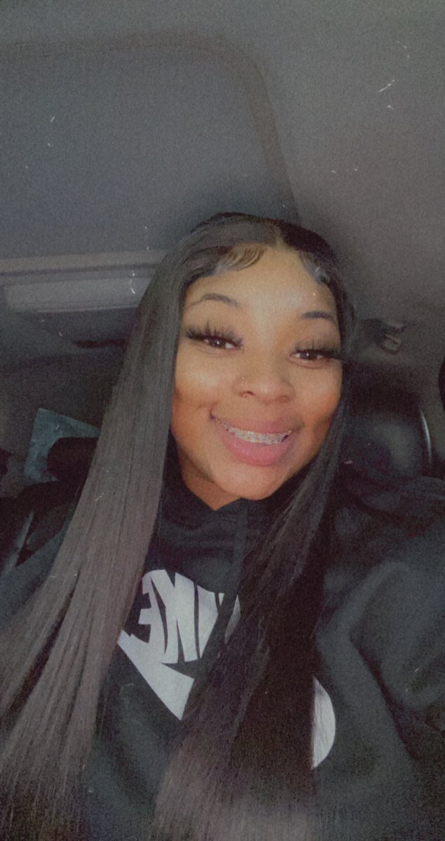 HairByTiaraW's tweet photo. #BraceFace https://t.co/OmTxbLVlp6