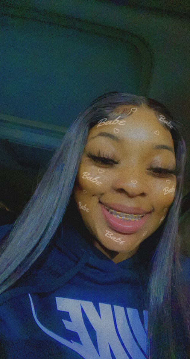 HairByTiaraW's tweet photo. #BraceFace https://t.co/OmTxbLVlp6