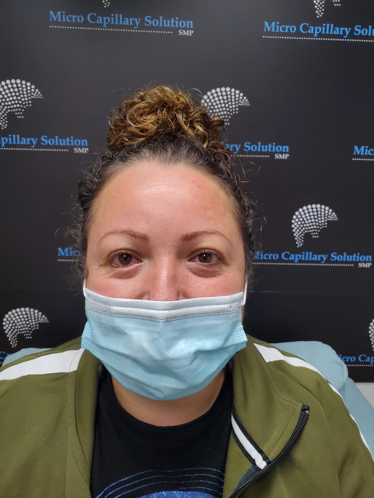 Micro Capillary Solution (microcapillary) / Twitter