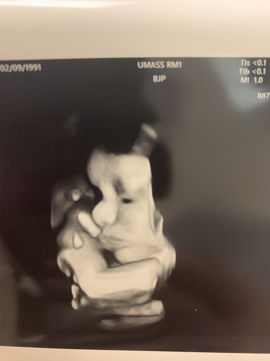 butt3rCup0906's tweet photo. Our first baby due tomorrow, could be any day now 🥰🤰🏻@HubbyWubbyBunz https://t.co/otqPWdbQKv