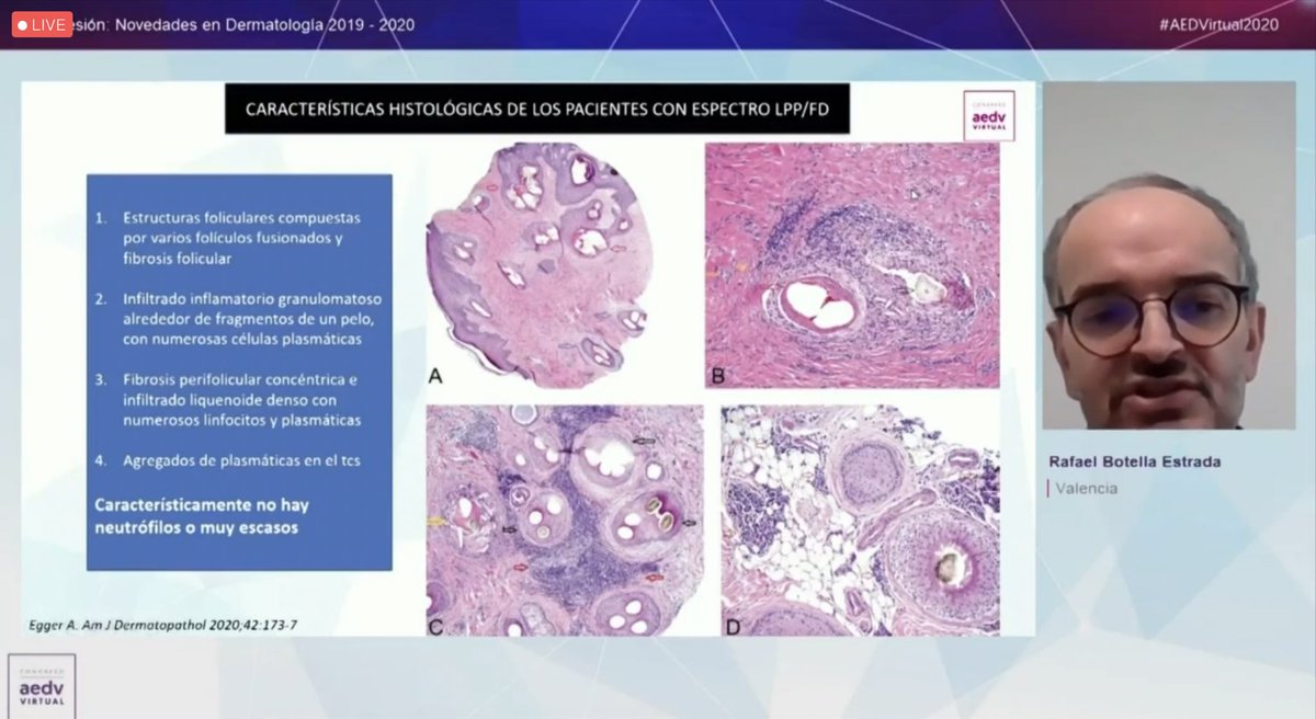 Características histológicas de los pacientes con espectro LPP/FD. Dr. Botella #AEDVIRTUAL2020