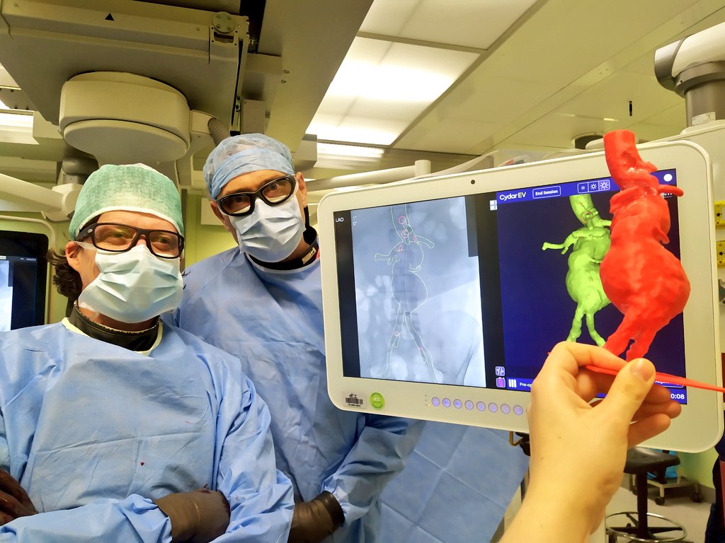 ETZ In-Hospital 3D Lab (@3dlab_etz) on Twitter photo Yesterday, our vascular surgeons used the <a href="/CydarMedical/">Cydar Medical</a> EV system and an in-house printed #3Dprint for a very interesting #FEVAR surgery. #MedTech Innovations used at its best! #innovation #surgery #FEVAR Yesterday, our vascular surgeons used the <a href="/CydarMedical/">Cydar Medical</a> EV system and an in-house printed #3Dprint for a very interesting #FEVAR surgery. #MedTech Innovations used at its best! #innovation #surgery #FEVAR