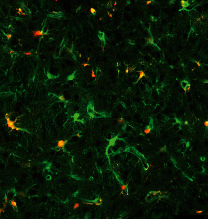GeneTherapy_SN's tweet photo. Trending this week is a preclinical #GTTech, developed @unil, for #neurodegenrativedisease which combines #lentiviral retrograde transport with surgical and cell-specific #genedelivery to improve transgene distribution in the central nervous system ➡️https://t.co/N1txwMxXjx https://t.co/Oi5n8d0vOC