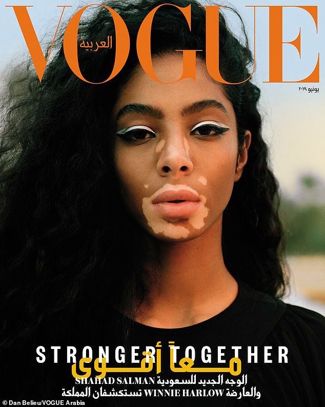 VitiligoProject's tweet photo. Here’s Winnie Harlow &amp; Shahad Salman showing the world true vitiligo beauty in @VogueArabia 😍 https://t.co/2FtKsRl1zk