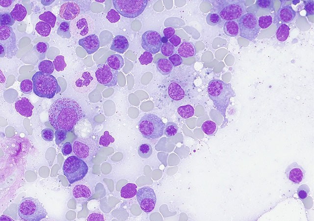 zeiss_micro's tweet image. In this webinar you will learn more about how to document your samples faster and more easily. Learn more about the concept and benefits of Smart Microscopy: zeiss.ly/zj8

#zeiss #microscopy #smartmicroscopy