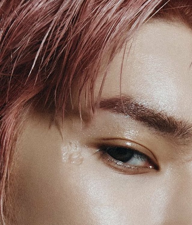 taeyong (nct) and the “rose„ scar in the corner of his right eye