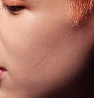 bambam (got7) and the 7-shaped scars on his cheekalso: undereye mole