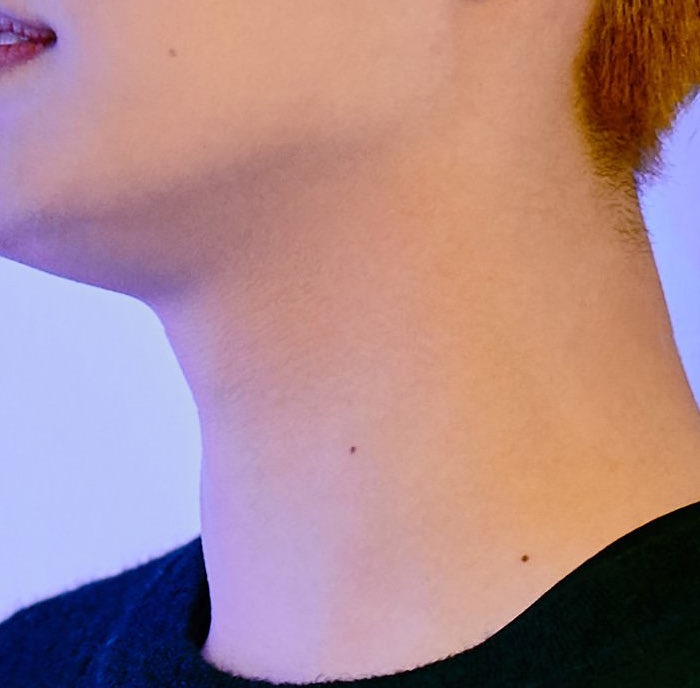 taeil (nct) and his cheek scaralso: moles