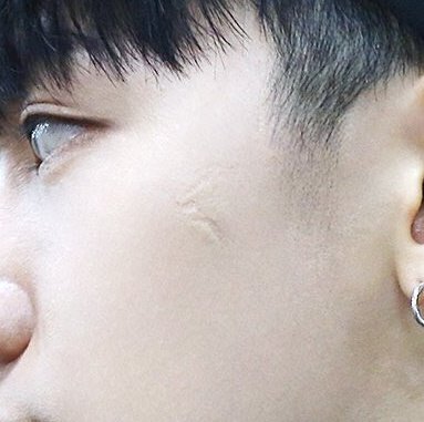 ten (nct) and the scar on his cheek as well as one on his chest, over which he got a self-design tattoo