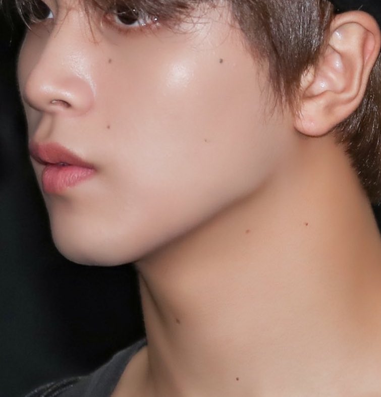 haechan (nct) and his constellation of molesalso: eyelid scars