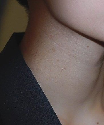 san (ateez) and his neck frecklesalso: moles