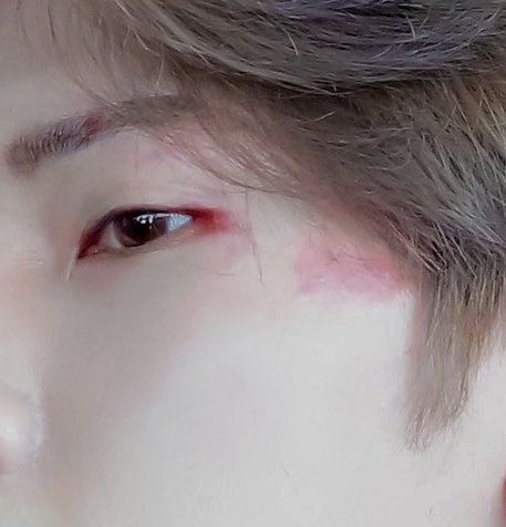 yeosang (ateez) and the birthmark on the corner of his left eye