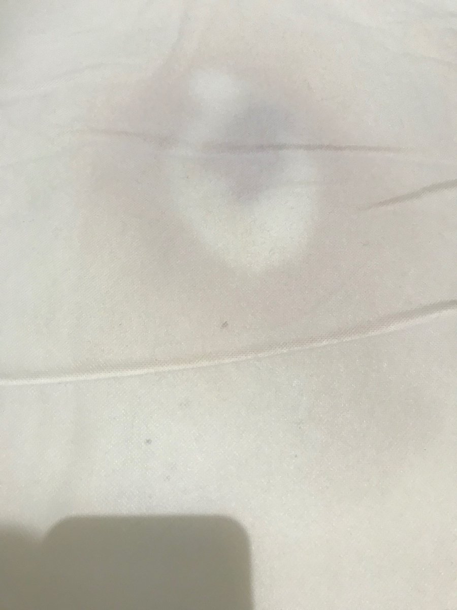 MrsEkelaka's tweet photo. @jlandpartners this is my baby daughters mattress after cleaning the black mould from her crib off it. I’ve also sent these pictures to customer services. When I tweeted you 7 hours ago I’m surprised &amp; disappointed you didn’t reply. https://t.co/PWVC3ZU2FL