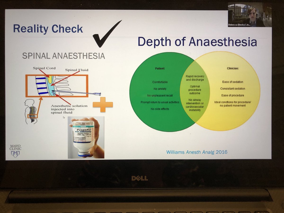 Sometimes a spinal is a general in disguise. We need to separate the differences, says ⁦<a href="/rljohnsonmd/">RLJohnson</a>⁩ #ASRAWORLDWIDE2020  #ASRAFALL20