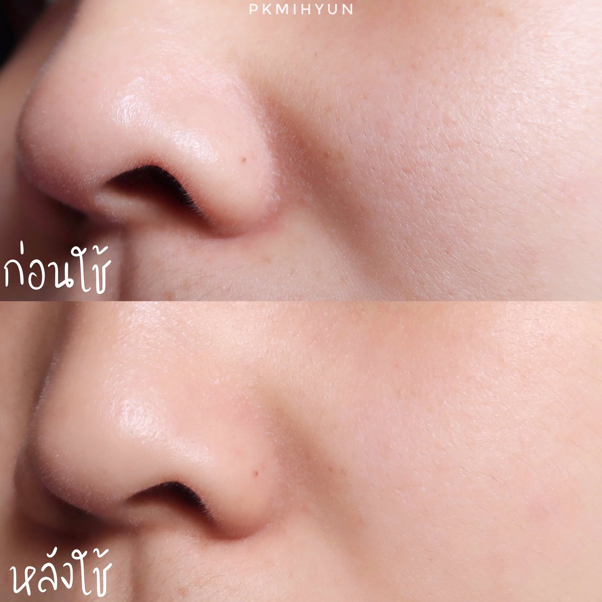 pkmihyun's tweet photo. ลองตัวนี้แล้วชอบอะครีมSOSเป็นเนื้อครีมที่ซึมไว ไม่เหนอะ ไม่รู้สึกหน้ามัน 
ผิวนุ่ม ฟู ดูดีขึ้นเยอะะ จากผิวแห้งๆแสบคันมันหายไปเลย เราผิวแพ้ง่ายมากๆใช้แล้วไม่แพ้ ไม่มีกลิ่น ไม่มีแอลกอฮอล์ น้ำหอม พาราเบน คนเป็นสิว ผิวแพ้ง่ายใช้ได้ เอาไป100/10 #ใช้ดีบอกต่อ https://t.co/u0P3P8c6fw